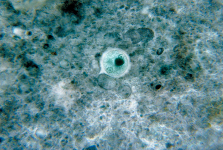 Picture 1 of Successful manufacture of amoeba vaccine after 20 years of research