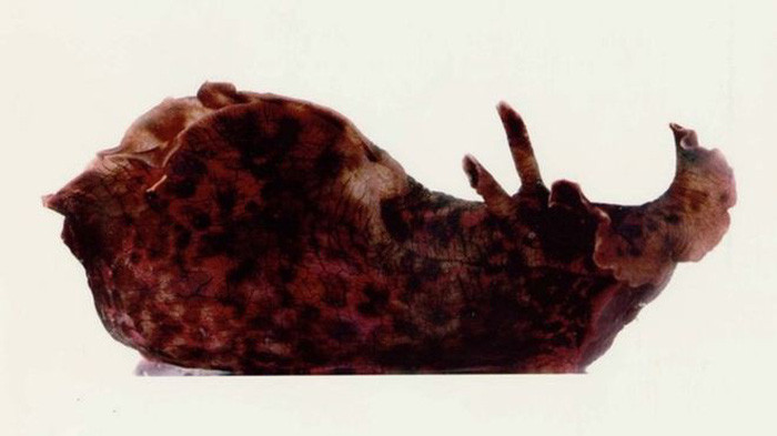 Picture 1 of Successful memory transplantation for snails
