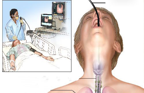 Picture 1 of Successful recovery of the trachea of ​​people with cancer