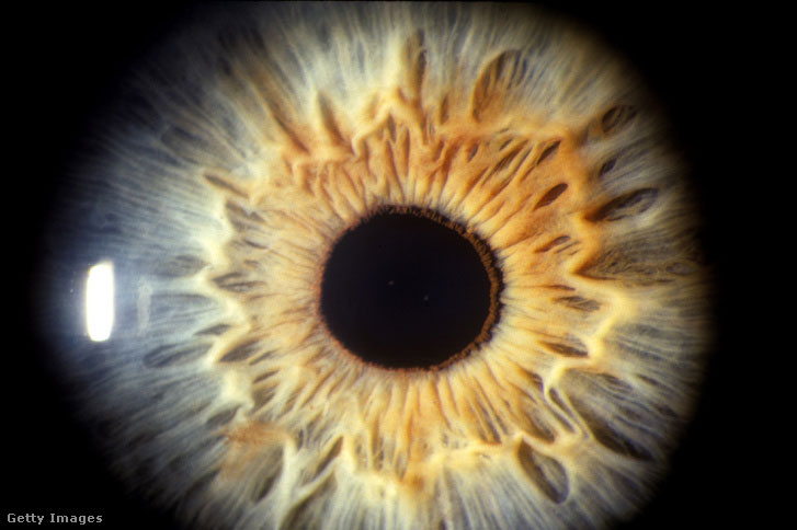 Picture 2 of Successful restoration of vision in mice by gene therapy