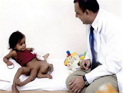 Picture 1 of Successful surgery in India for 8 girls