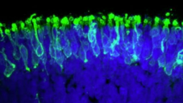 Picture 1 of Successfully cultured retina from versatile stem cells