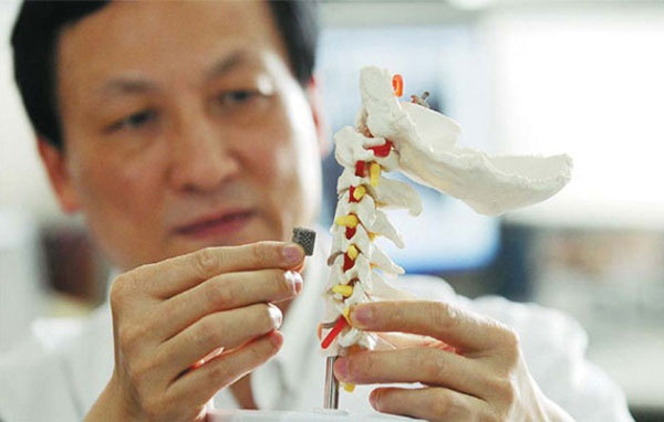 Picture 1 of Successfully implanted 3D print vertebrae on human body