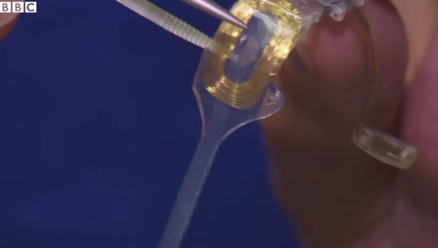 Picture 3 of Successfully implanted artificial eyes for humans