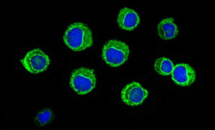 Picture 1 of Successfully modulate drugs that can cure blood cancer