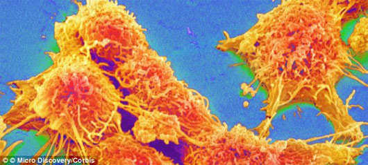 Picture 1 of Successfully rearing the tumor separated the body