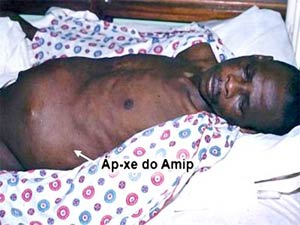 Picture 1 of Successfully tested Amip parasitic vaccine