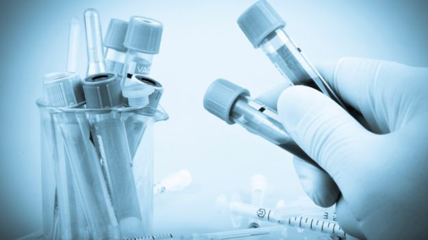 Picture 3 of Successfully tested anti-cancer vaccine - 12 people cured