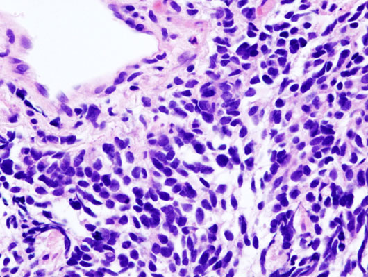 Picture 1 of Successfully transformed stem cells into lung cells