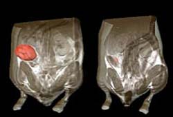 Picture 1 of Sudden transgene causes the tumors to shrink