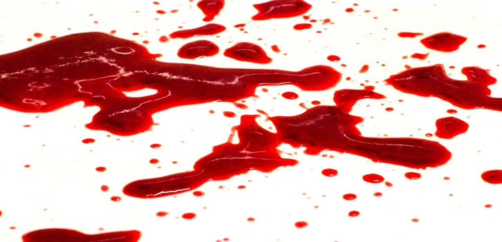 Picture 4 of Surprise about the reason why many people see blood is fainting