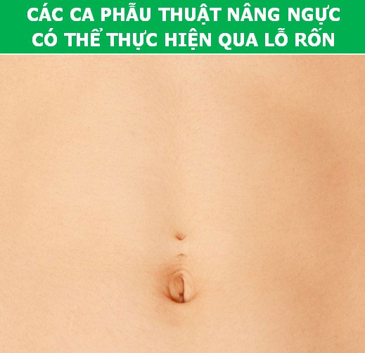 Picture 7 of Surprised by the scientific facts about ... the belly button