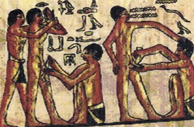 Picture 3 of Surprised poisoning the body of ancient Egyptians