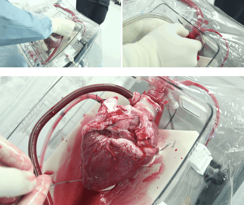 Picture 4 of Surprised to see the human heart still beating outside the body while waiting for a transplant