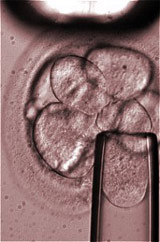 Picture 1 of Take stem cells without destroying the embryo