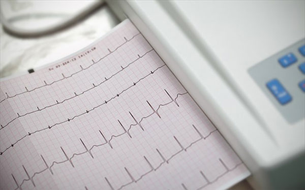 Picture 1 of Taking photos of face diagnosis of heart condition
