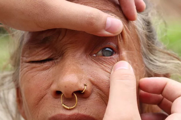 Picture 1 of Talents help blind people see after ... 5 minutes