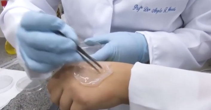 Picture 1 of Tape made from pineapple helps wound healing