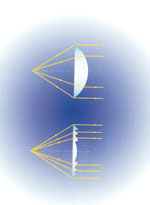 Picture 2 of Technical advances of the lighthouse