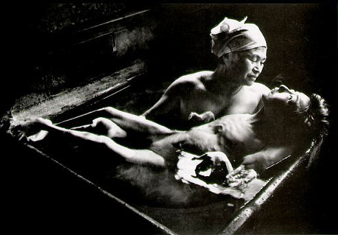Picture 4 of Terrifying cases of mercury poisoning in history