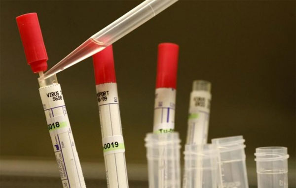 Picture 1 of Test method for treating Ebola