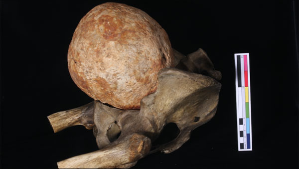Picture 1 of The 200-year-old stone uterus weighs 3kg in England