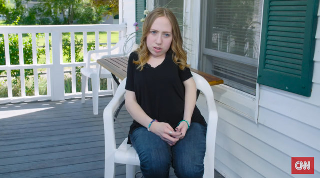 Picture 3 of The 23-year-old girl simultaneously raised 2 bones on her body