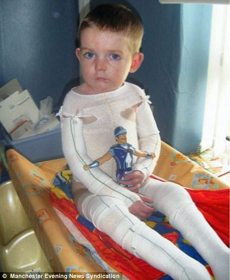 Picture 3 of The 6-year-old boy always suffered from blistering skin