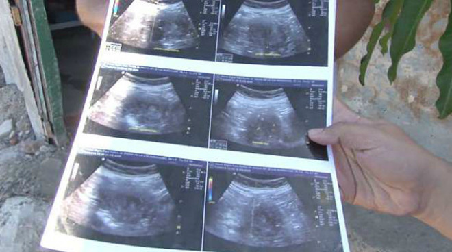 Picture 2 of The 70-year-old grandmother announced she was pregnant with the 8th child