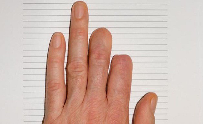 Picture 1 of The 7-year-old girl has the ability to grow back her fingers no different from Namek