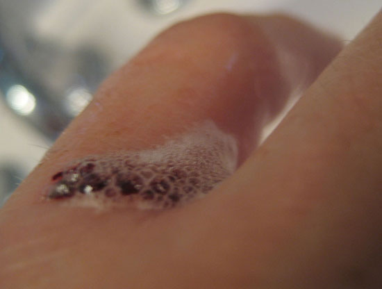 Picture 1 of The ability to heal the wound of old oxygen