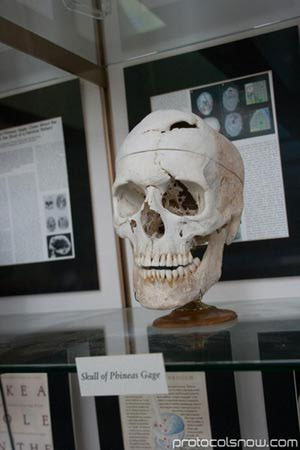 Picture 3 of The amazing truth about the head amputee is still 'life'.