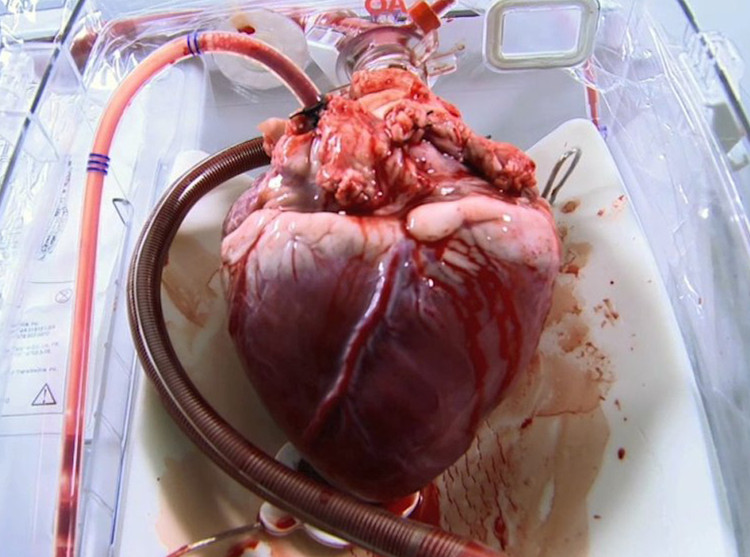 Picture 3 of The ambition to create a heart that works with nuclear energy by American scientists