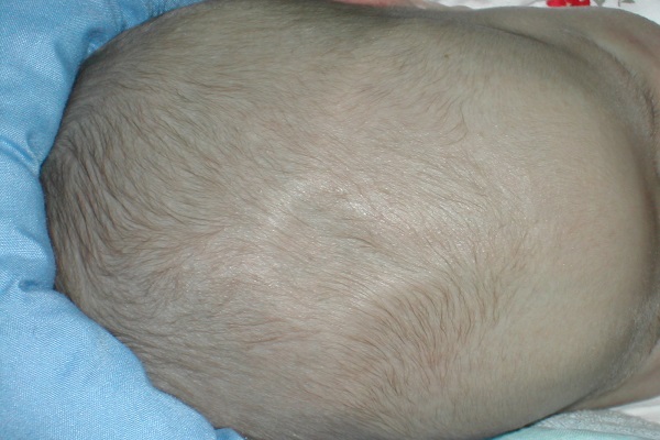 Picture 3 of The baby who is close to it sooner or later is worrying