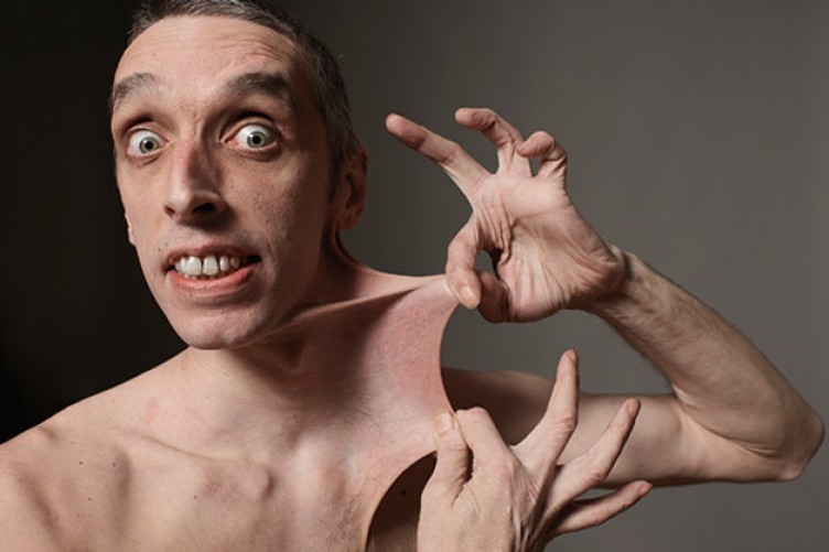 Picture 14 of The biggest 'biggest', 'the longest' in humans