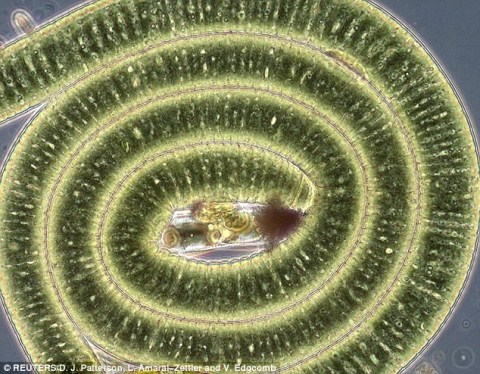 Picture 3 of The bizarre bacterial world