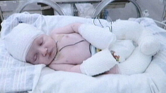 Picture 1 of The boy has no skin
