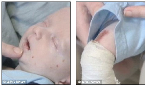 Picture 3 of The boy has no skin
