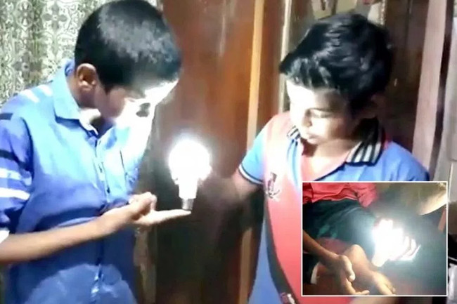 Picture 2 of The boy has the miraculous ability: lighting electricity with skin