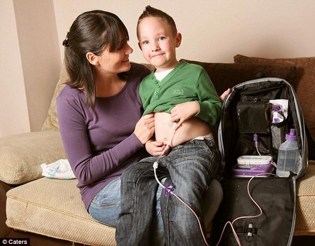 Picture 1 of The boy must fast all his life
