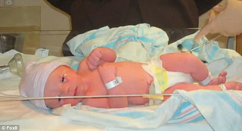 Picture 6 of The boy remembered his previous life as a woman who died in a fire