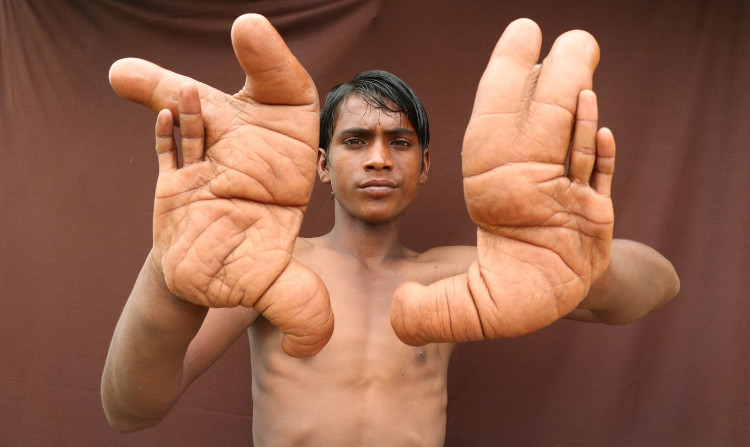 Picture 1 of The boy's gigantic hand made the medicine clasped