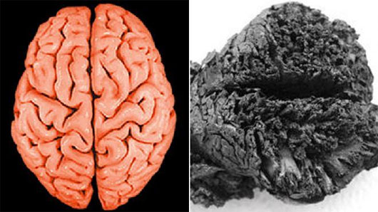 Picture 1 of The brain is well preserved 4,000 years