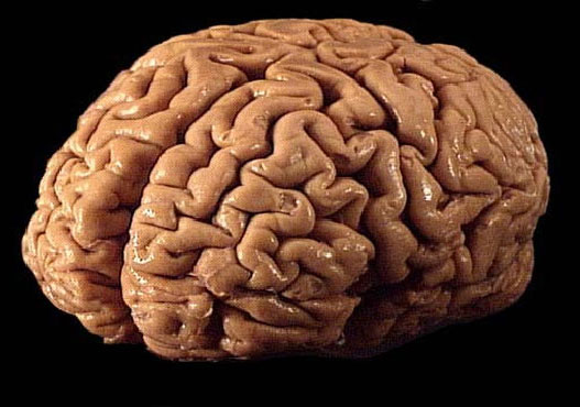 Picture 1 of The brain of genius and idiot 95% alike