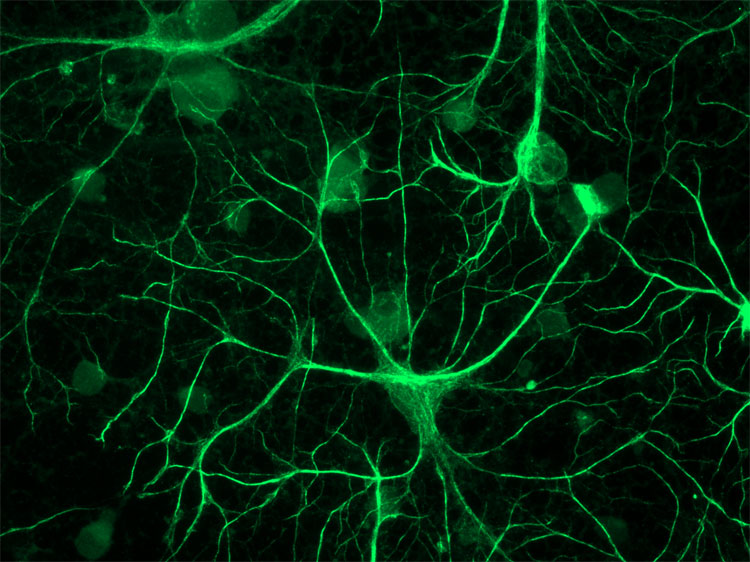 Picture 2 of The brain will destroy itself if the body lacks regular sleep