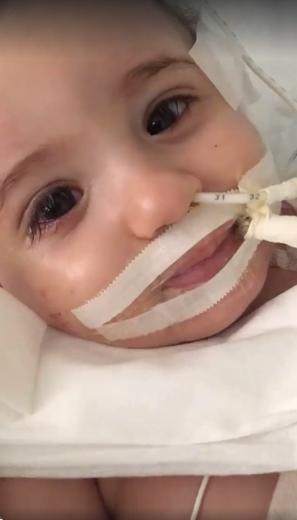 Picture 1 of The child patient awakened miraculously after the doctor was about to withdraw his breathing tube