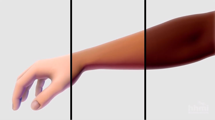 Picture 1 of The culprit causes the skin to become discolored when exposed to sunlight