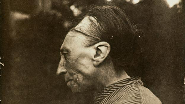 Picture 2 of The custom of extending the skull of the South American tribe