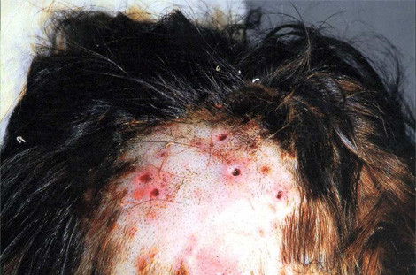 Picture 3 of The dangerous 'carnivorous' parasite has returned and is more beneficial than before