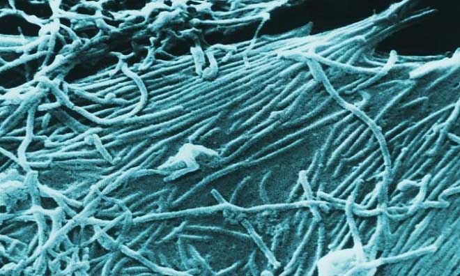 Picture 2 of The dangerous viruses on Earth